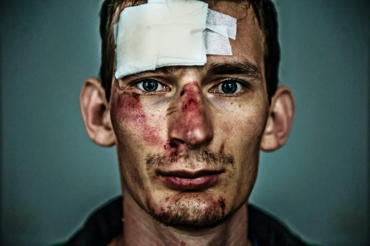 Image of a man with a tattered up face. Source: tom jur, unsplash